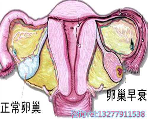 杭州代生，孕囊为什么会掉到宫颈口