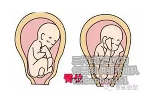 <b>上海靠谱供卵机构_去泰国做试管婴儿前的准备与注意事项</b>