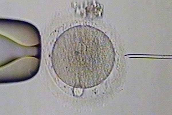 上海专业供卵价格表_俄罗斯试管婴儿基因检测对囊胚会有伤害吗？